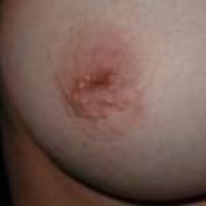 Επίπεδες, εισέχουσες ή ανεστραμμένες θηλές. Τι είναι;