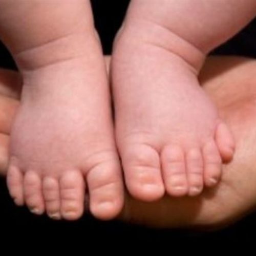 Θηλασμός και αλλεργίες