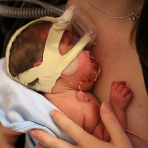 Όταν το μητρικό γάλα ήταν το μόνο που μπορούσα να προσφέρω